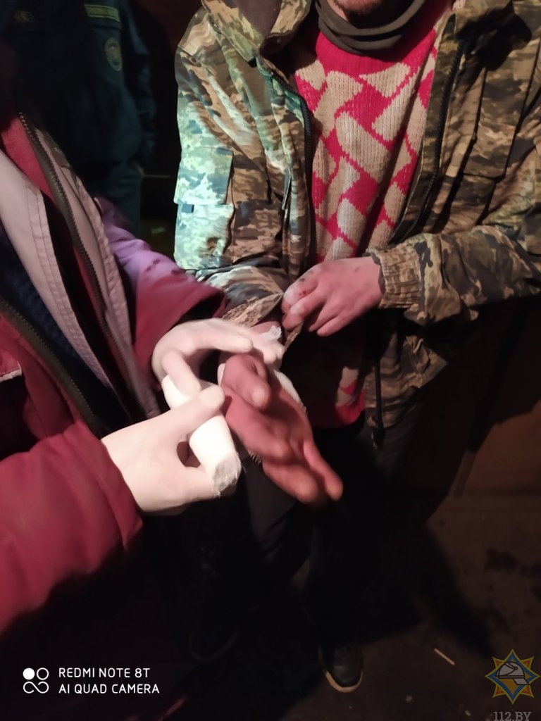 В Докшицах мужчина получил ожоги, пытаясь самостоятельно потушить пожар в доме
