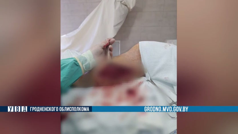 Белорус получил огнестрельные ранения в Польше  
