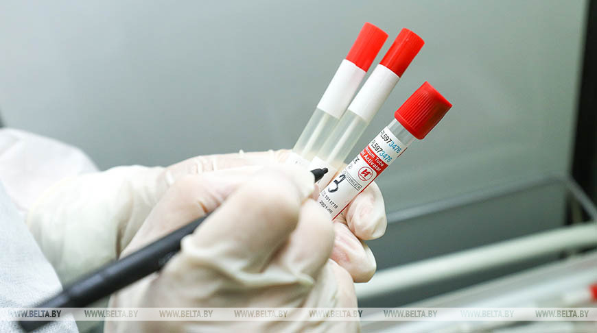 Популяционный иммунитет к COVID-19 в Беларуси после первой волны оценивается в 15-20%