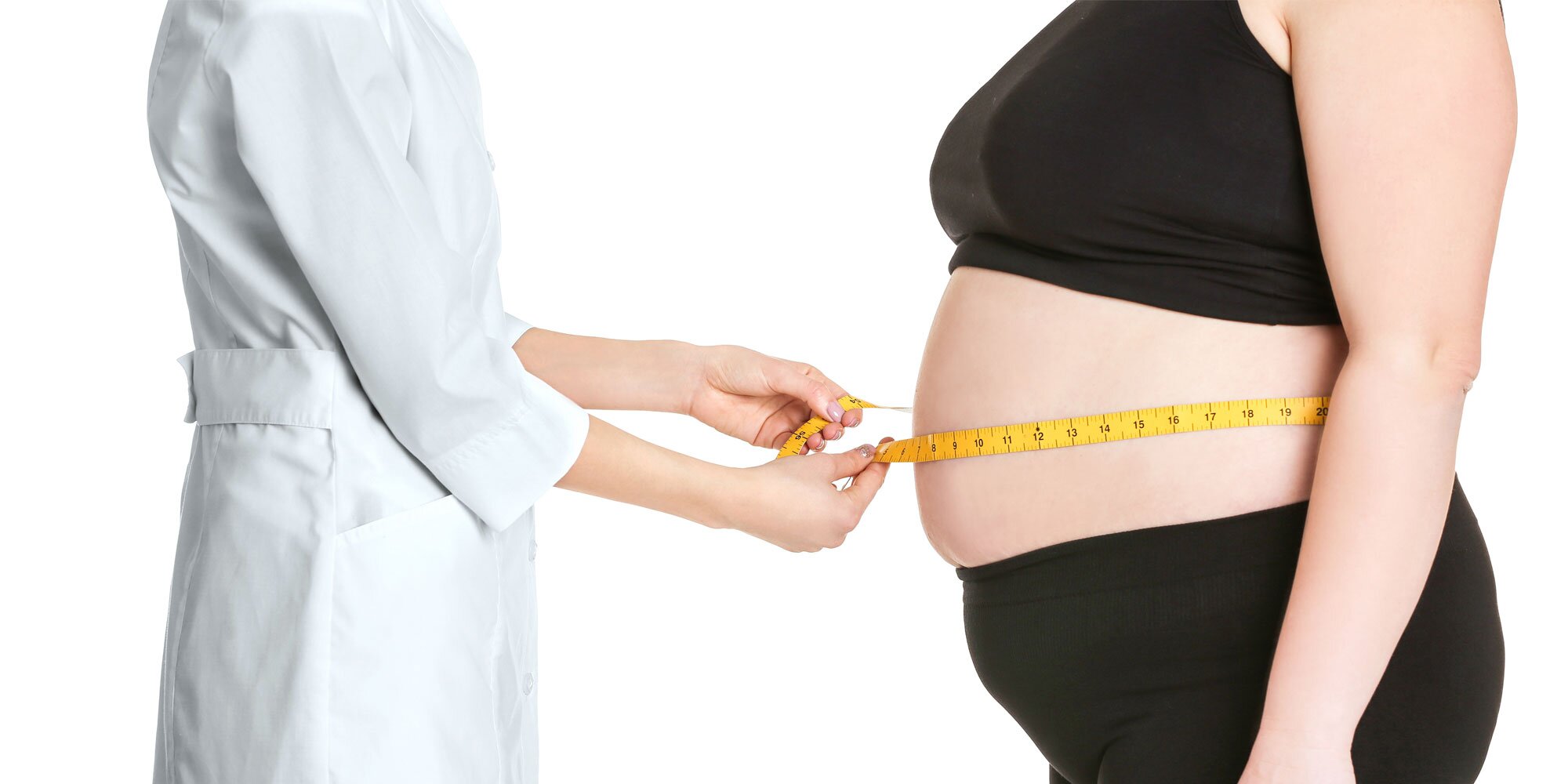 Болезнь растет живот. Ожирение. Лишний вес и ожирение. Абдоминальное ожирение. Лишний вес у женщин.