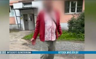 7 ножевых ударов нанесли женщине в Витебске